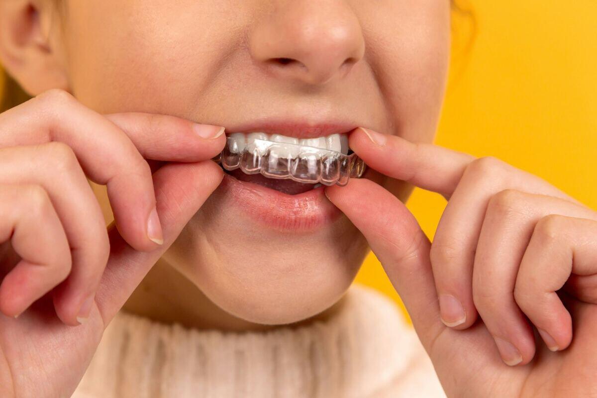 Clear aligner